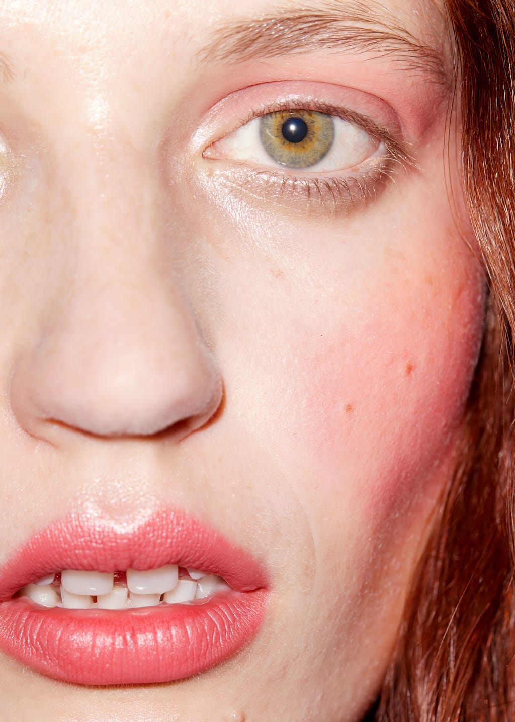 Image of Cheek & Lip
