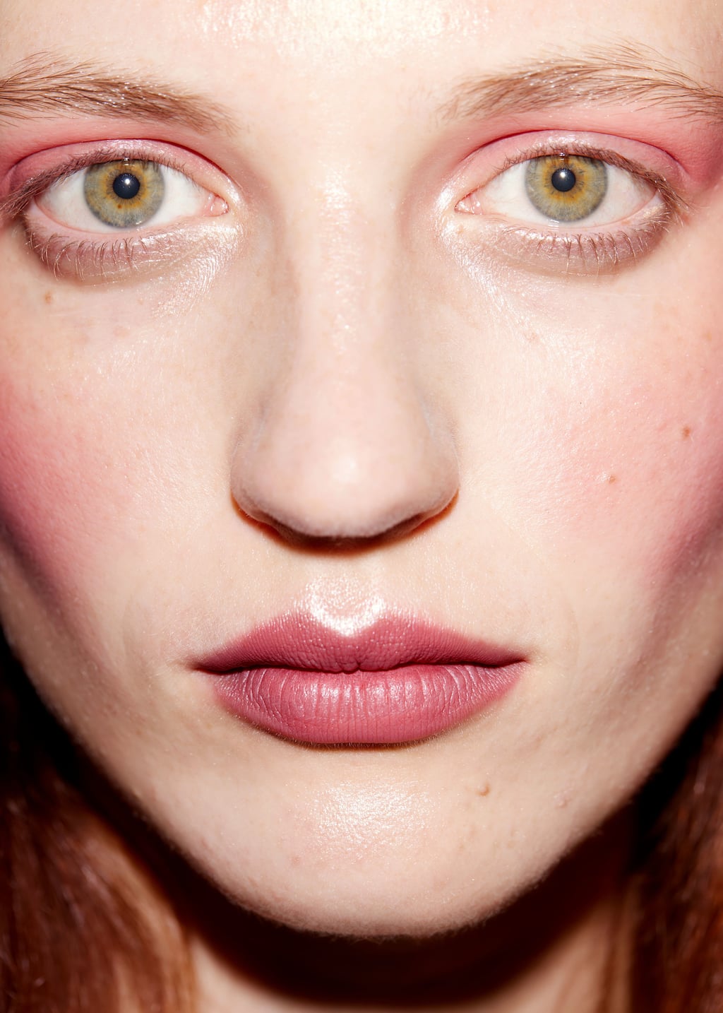 Image of Cheek & Lip